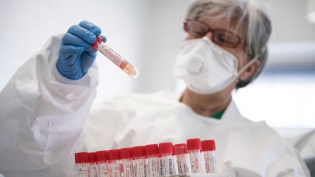 Dünyanın COVID statistikası: 618 milyon nəfər...