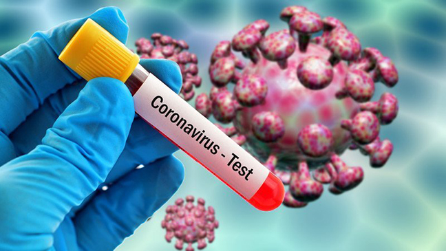 65 yeni yoluxma aşkarlandı - Ölən yoxdur