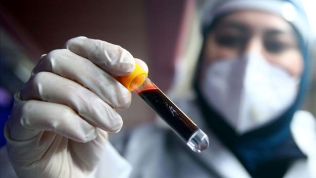 Dünyada koronavirus MƏNZƏRƏSİ: Milyonlarla insan...