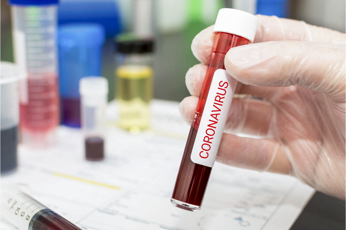21 nəfər koronavirusa yoluxdu, biri öldü