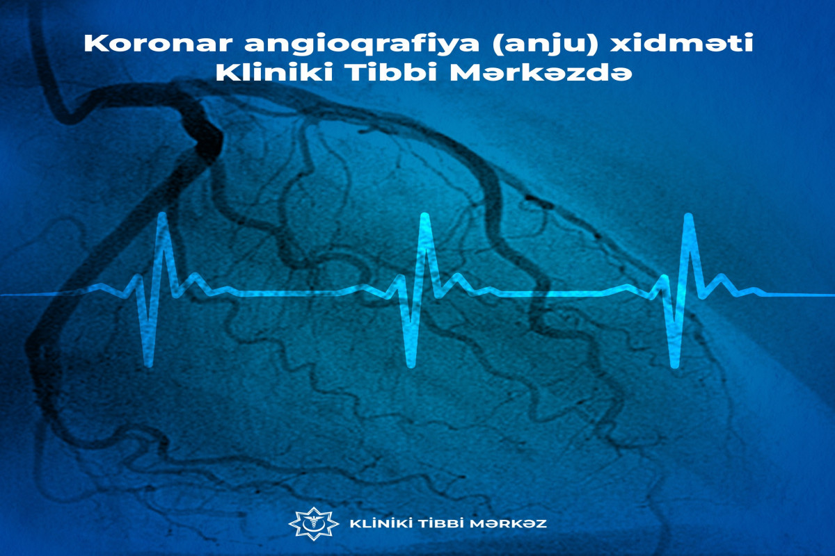 Kliniki Tibbi Mərkəzdə yeni xidmət fəaliyyətə BAŞLADI
