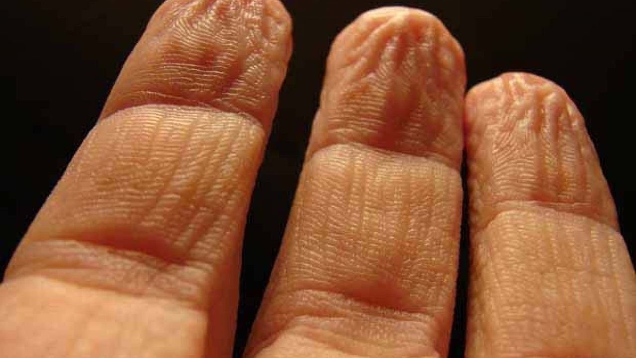 Barmaqların qırışması nədən xəbər verir?