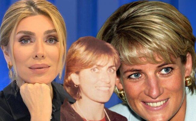 Əməliyyatdan əvvəl Dianaya oxşayırdım - Xoşqədəm