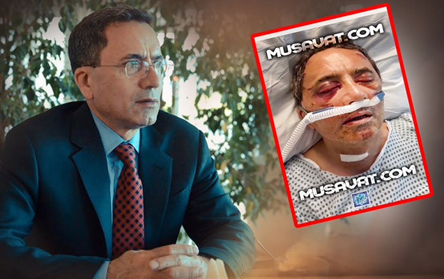 Əhməd Obalını və oğlunu ABŞ-da ölümcül döydülər