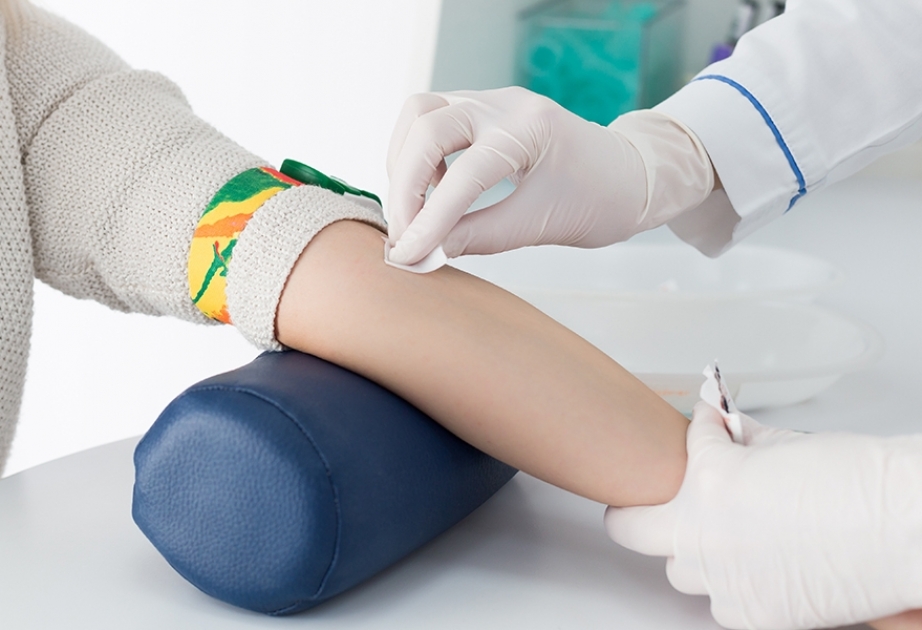 İldə iki dəfə İİV müayinəsindən keçmək lazımdır 