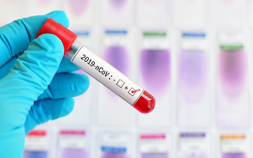 Daha 11 nəfər yoluxdu - Ölən yoxdur