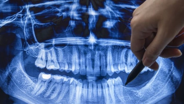 Yeni diş çıxaran dərman İCAD EDİLDİ