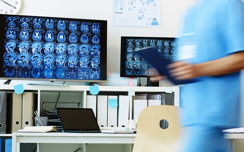 Beyin xərçənginin müalicəsi üçün effektiv üsul