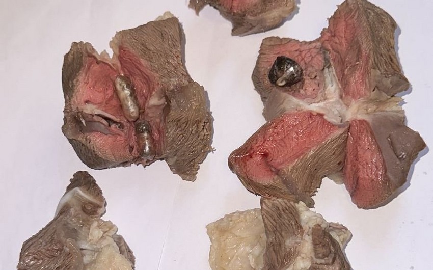 Həbsxanaya ətin içində narkotik keçirmək istədi