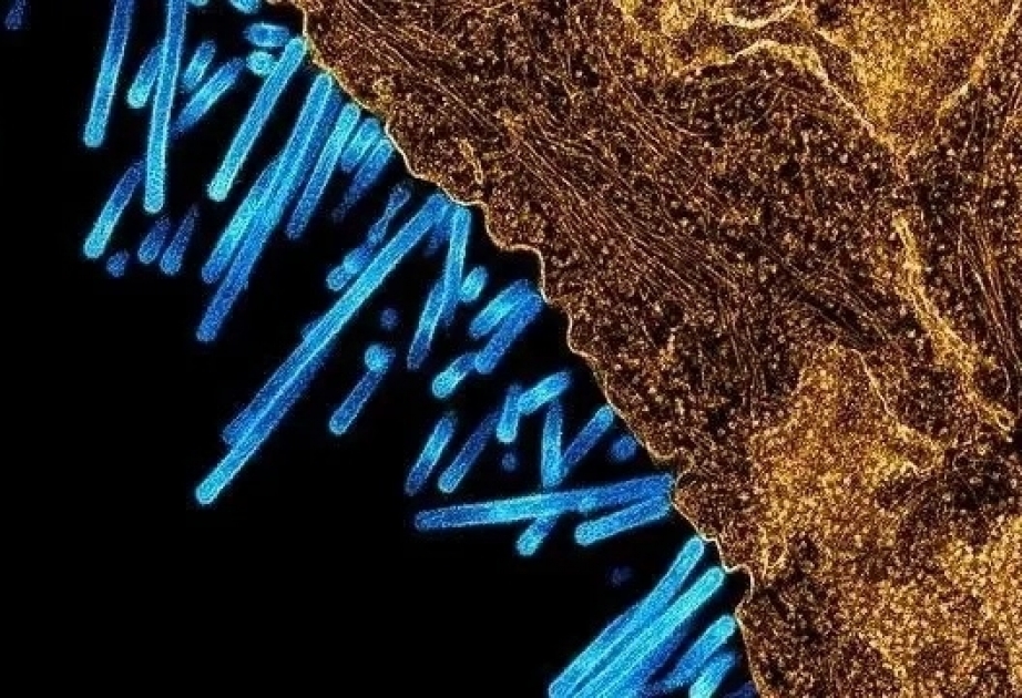 Britaniyada donuz qripi - İlk dəfə aşkarlandı