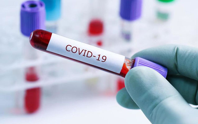 Ötən həftə 17 nəfər COVID-19-a yoluxub - 1 nəfər ölüb