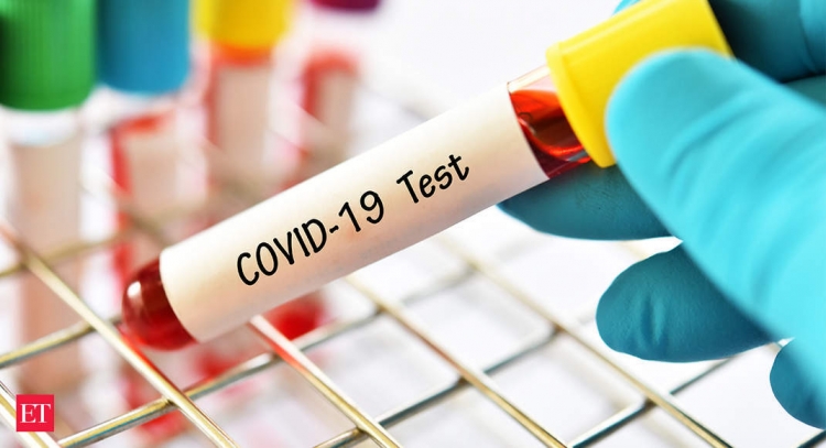 Azərbaycanda COVID-19-un yeni ştamı yayılıb? - Nazirlikdən açıqlama