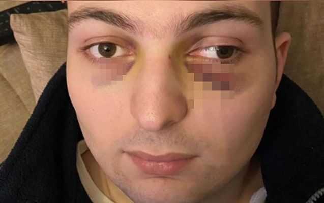 Ticarət mərkəzində döyülən oğlanla bağlı araşdırma BAŞLADI