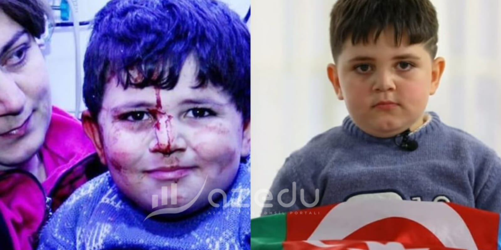 Gəncə terrorunun balaca qurbanı: "Polad Həşimov kimi olmaq istəyirəm" 