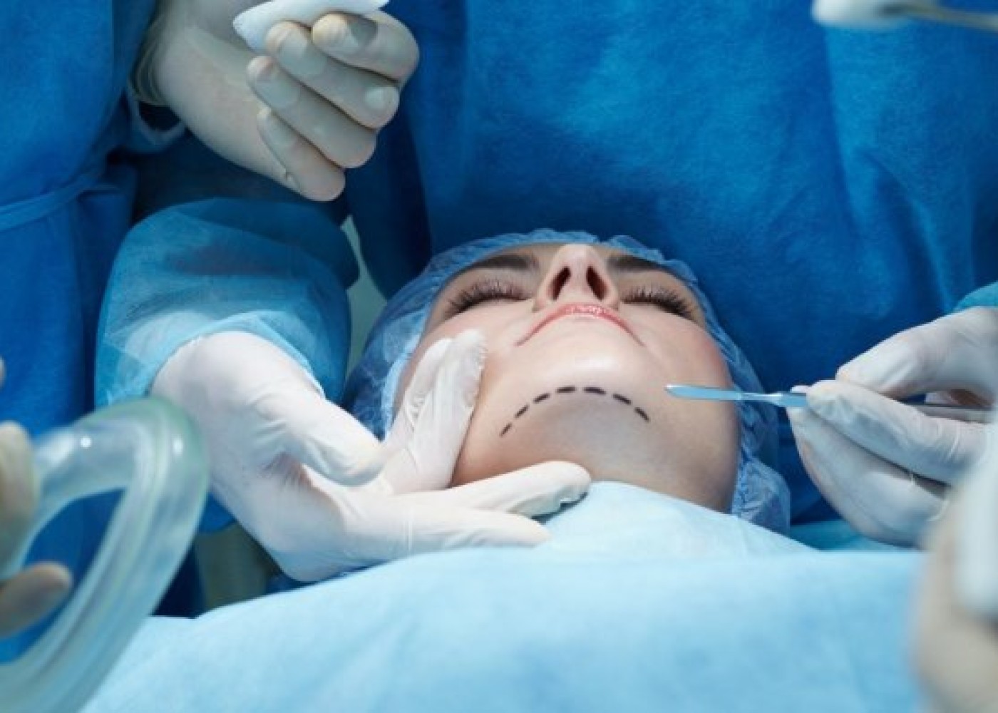 Azərbaycanda məşhur plastik cərrah ifşa edildi: sertifikatı YOX İMİŞ