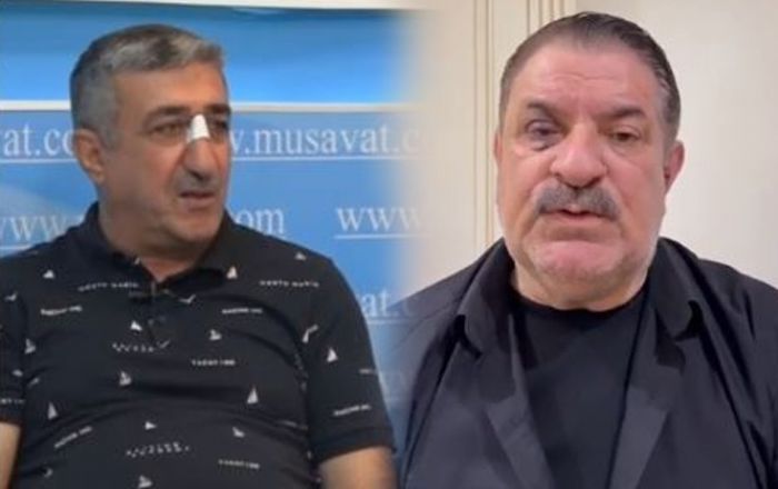 Ağadadaş Ağayevin balta atdığı mühafizəçinin istintaqı başa çatdı