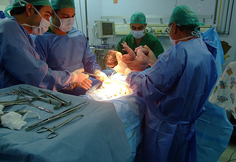 26 yaşlı ana qeysəriyyə əməliyyatından sonra ÖLDÜ