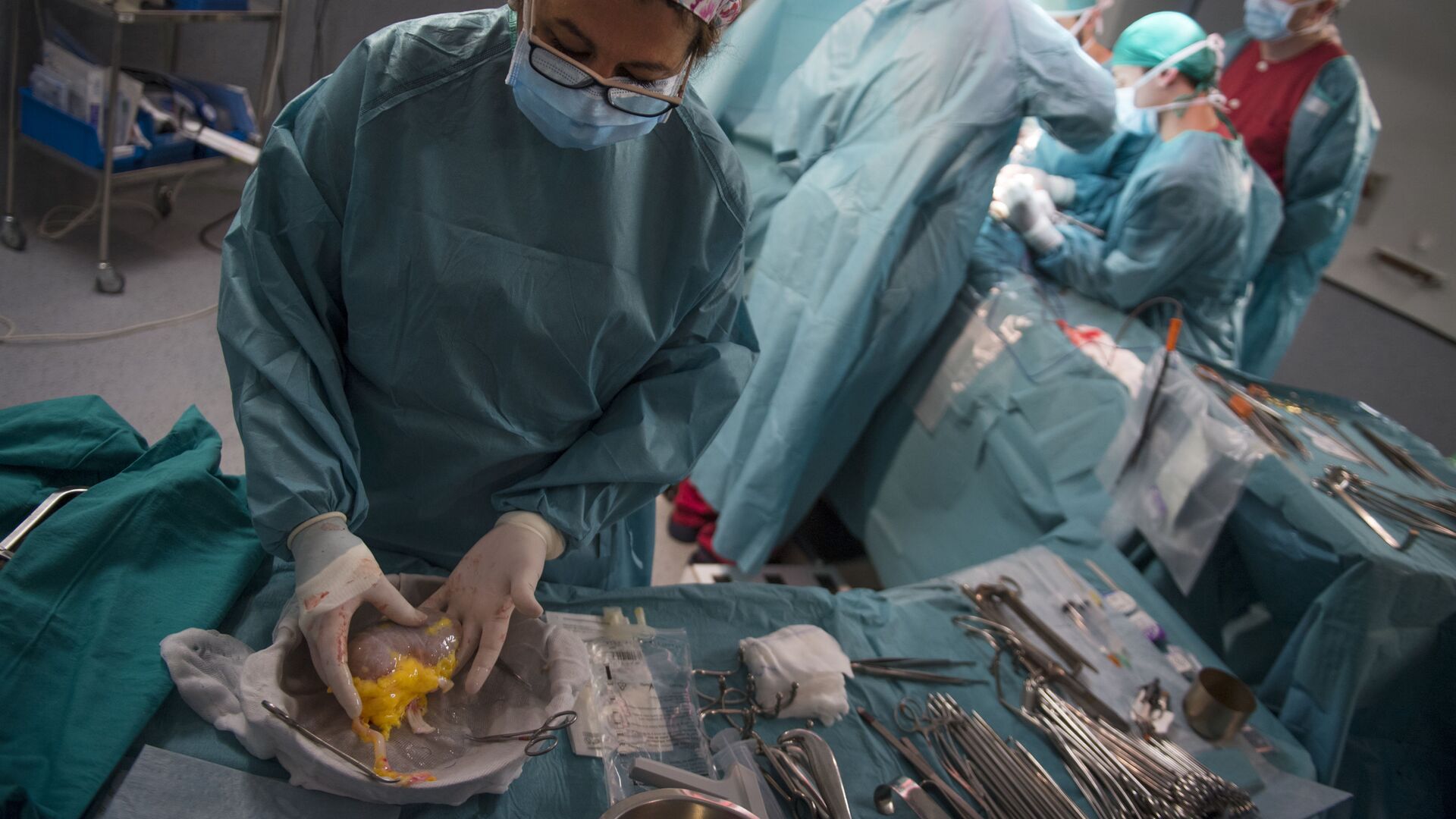 Azərbaycanda ilk - Meyit donorun orqanları transplantasiya edildi