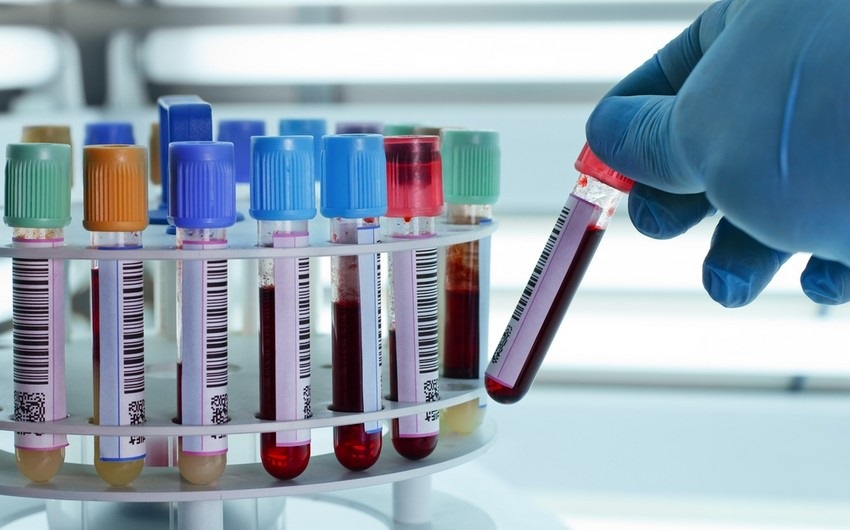 Azərbaycanda ötən il 634 nəfərdə hepatit aşkarlanıb