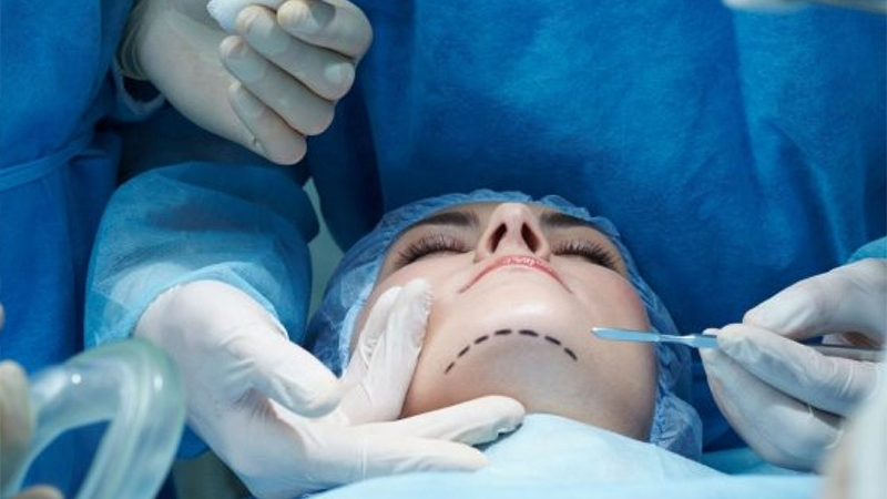 Plastik cərrahlara rüşvətlə sertifikasiya verən vəzifəli şəxslər - Adlar AÇIQLANDI