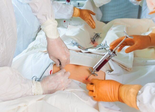 Sümük iliyi köçürməsi tibbi sığorta ilə mümkün olacaq