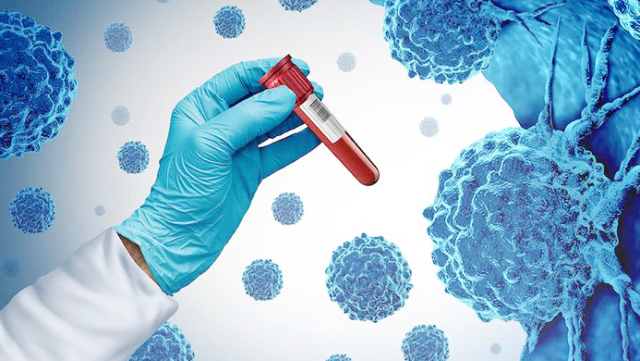 Bu xəstəliklərin diaqnostikası icbari tibbi sığortaya daxil edildi