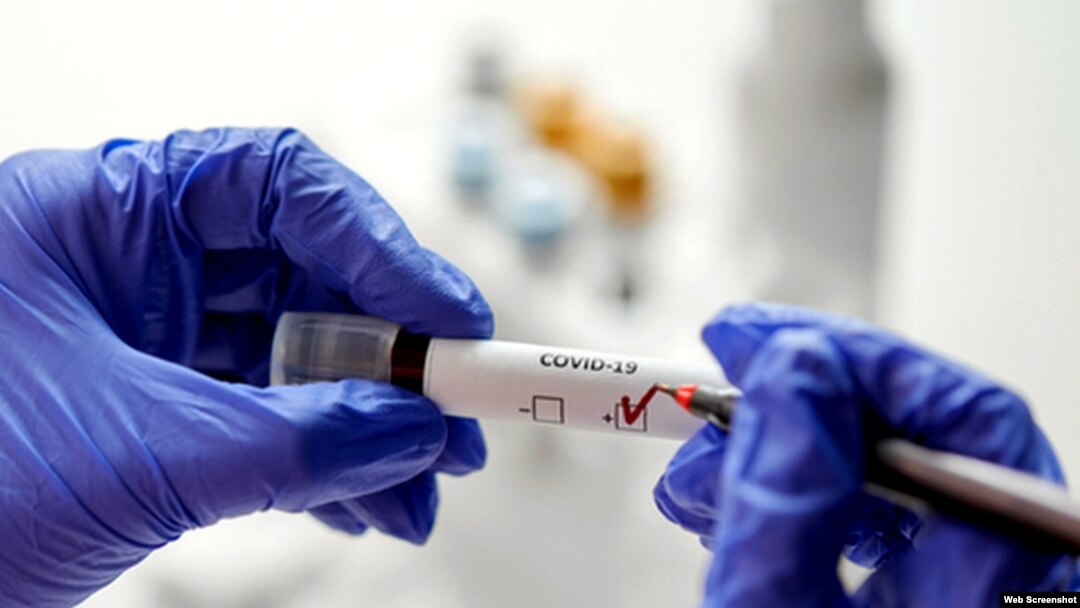 Azərbaycanda COVİD-19-a yoluxanlar var - RƏSMİ