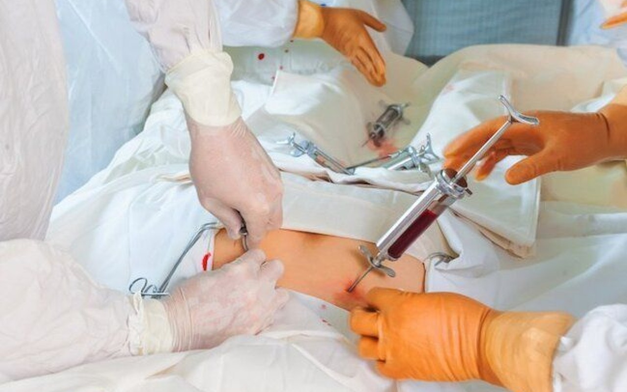 Sümük iliyinin transplantasiyasını həyata keçirən xəstəxanaların sayı ARTIRILDI