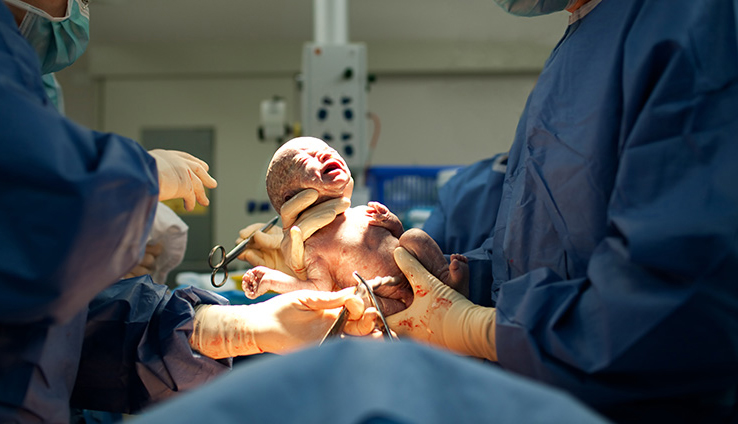 &ldquo;Qeysəriyyə əməliyyatlarının sayı 10 faizədək azalıb&rdquo;&nbsp;