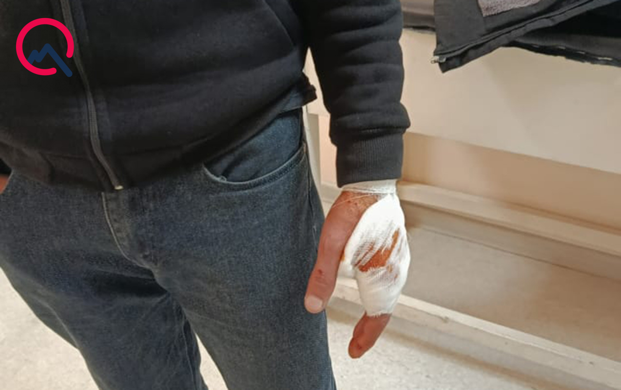 Şəkidə canavar kəndə hücum etdi - Xəsarət alanlar var