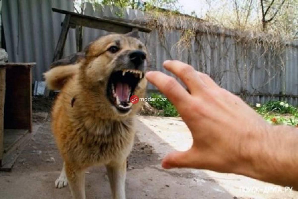 Bakıda "it kabusu": Bir ayda 65 nəfər xəsarət alıb