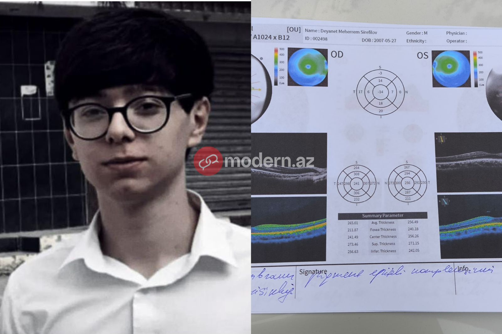 Reaction to Modern.az's article: Visually impaired conscript sent for re-examination