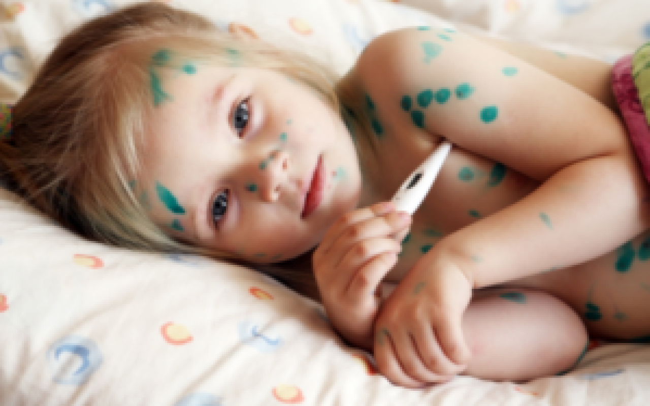 Su çiçəyinə yoluxma ARTIB