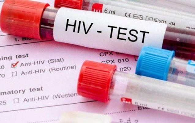В Азербайджане 1287 человек&nbsp;заразились СПИДом