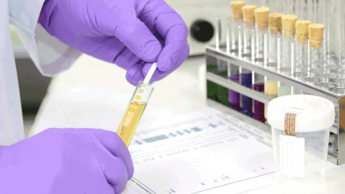 Narkoloji xəstələrlə bağlı işə qəbul qaydaları sərtləşdirilir