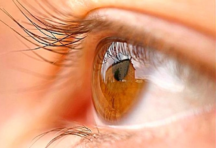 Azərbaycanda Göz Bankı açılacaq