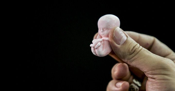 Azərbaycanda abortların sayı rekord həddə çatıb