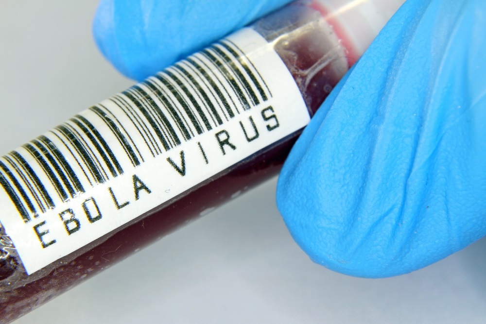 ÜST: Ebola virusu sürətlə yayılır