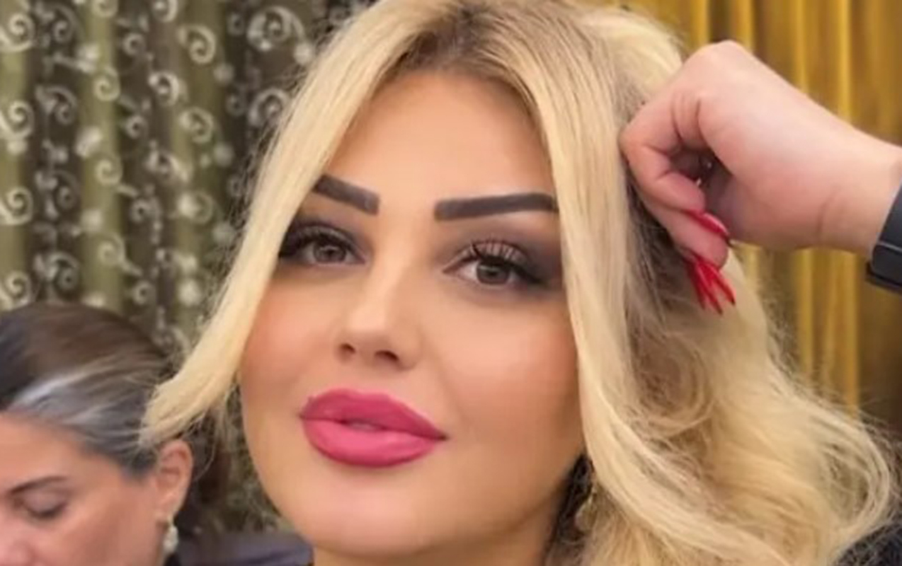 Bakıda dişini çəkdirən qadın vəfat etdi - GÖRÜNTÜ