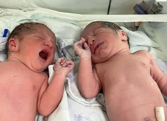 13 yaşlı qız əkiz uşaq dünyaya gətirdi: körpələrdən biri öldü